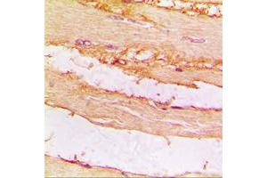 Immunohistochemical analysis of CKMT2 staining in human muscle formalin fixed paraffin embedded tissue section. (CKMT2 antibody  (Center))