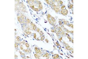 Immunohistochemistry of paraffin-embedded human stomach using DARS2 antibody.