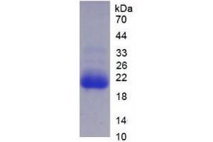 SDS-PAGE analysis of Human CYP3A7 Protein.
