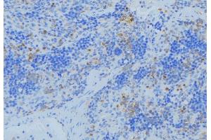 ABIN6273682 at 1/100 staining Human lymph node tissue by IHC-P. (Keratin 36 antibody  (Internal Region))
