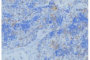 ABIN6273682 at 1/100 staining Human lymph node tissue by IHC-P.