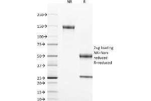 SDS-PAGE Analysis Purified CD40 Mouse Monoclonal Antibody (T8P2G4*A6). (CD40 antibody  (C-Term))