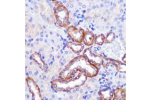 Immunohistochemistry of paraffin-embedded Mouse kidney using PIGM Rabbit pAb (ABIN7269294) at dilution of 1:100 (40x lens). (PIGM antibody  (AA 35-96))