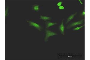 Immunofluorescence of purified MaxPab antibody to CCNT1 on HeLa cell. (Cyclin T1 antibody  (AA 1-726))