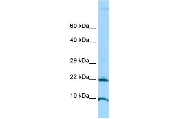 ADAT2 antibody  (N-Term)