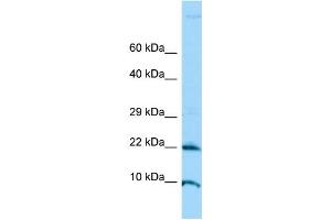 WB Suggested Anti-ADAT2 Antibody Titration: 1. (ADAT2 antibody  (N-Term))
