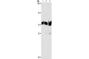 Western Blotting (WB) image for anti-B-Raf proto-oncogene, serine/threonine kinase (BRAF) antibody (ABIN2425628) (BRAF antibody)