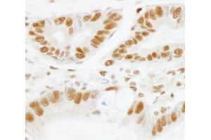Immunohistochemistry (IHC) image for anti-Splicing Factor 3b, Subunit 1, 155kDa (SF3B1) (AA 200-250) antibody (ABIN7448791)