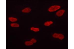 ABIN6267684 staining HT-1080 cells by ICC/IF. (Aurora Kinase B antibody  (pThr232))
