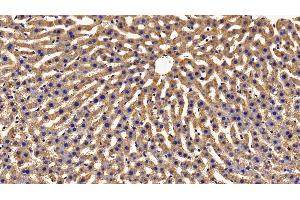 Detection of GHR in Rat Liver Tissue using Polyclonal Antibody to Growth Hormone Receptor (GHR) (Growth Hormone Receptor antibody  (AA 353-588))