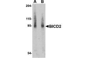Western Blotting (WB) image for anti-Bicaudal D Homolog 2 (BICD2) (Middle Region) antibody (ABIN1030887) (BICD2 antibody  (Middle Region))