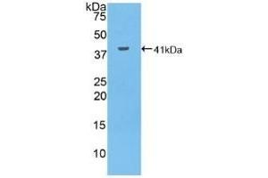 Detection of Recombinant MUC6, Human using Polyclonal Antibody to Mucin 6 (MUC6) (MUC6 antibody  (AA 2338-2439))