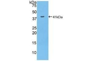Detection of Recombinant MUC6, Human using Polyclonal Antibody to Mucin 6 (MUC6) (MUC6 antibody  (AA 2338-2439))
