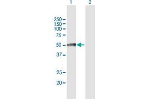 Western Blot analysis of SCLY expression in transfected 293T cell line by SCLY MaxPab polyclonal antibody. (SCLY antibody  (AA 1-445))
