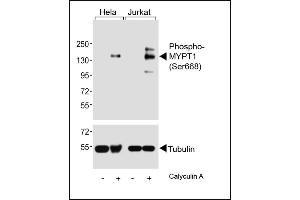 Western blot analysis of lysates from Hela, Jurkat cell line, untreated or treated with Calyculin A, 100nM, using (ABIN6241041 and ABIN6578962) (upper) or Tubulin (lower). (PPP1R12A antibody  (pSer668))