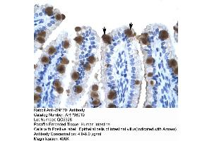 Human Intestine (ZNF70 antibody  (N-Term))