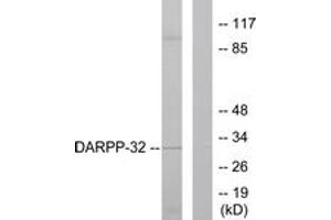 Western blot analysis of extracts from 293 cells, treated with EGF 200ng/ml 30', using DARPP-32 (Ab-75) Antibody. (DARPP32 antibody  (AA 41-90))