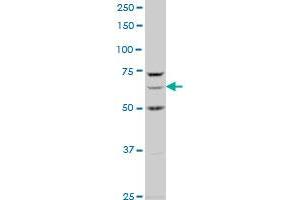 AKAP1 polyclonal antibody (A01), Lot # 061130JCS1 Western Blot analysis of AKAP1 expression in HeLa . (AKAP1 antibody  (AA 806-903))