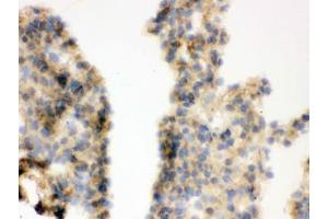 IHC testing of frozen mouse lung tissue with COMT antibody. (COMT antibody  (AA 52-271))