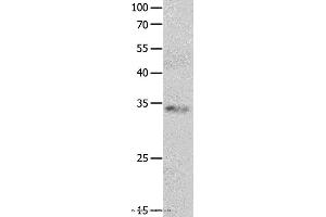 Western blot analysis of Jurkat cell, using RBFOX3 Polyclonal Antibody at dilution of 1:550 (NeuN antibody)
