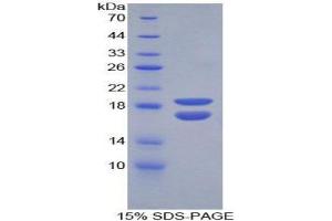 SDS-PAGE (SDS) image for phosphohistidine Phosphatase 1 (PHPT1) (AA 1-124) protein (His tag) (ABIN1080513)