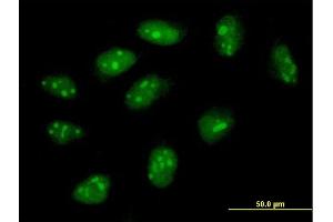Immunofluorescence of purified MaxPab antibody to FLJ11184 on HeLa cell. (C4orf43 antibody  (AA 1-203))