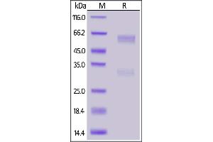 SDS-PAGE (SDS) image for SARS-CoV-2 Nucleocapsid (SARS-CoV-2 N) (Active) protein (His tag,AVI tag,Biotin) (ABIN6973237)