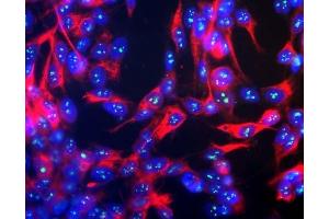 Human SH-SY5Y cells stained with ABIN1580417, showing prominent specular nucleolar staining. (Fibrillarin antibody)