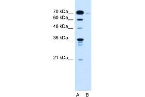 WB Suggested Anti-KLHL31 Antibody Titration:  0. (KLHL31 antibody  (C-Term))