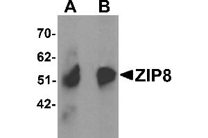 Western Blotting (WB) image for anti-Solute Carrier Family 39 (Zinc Transporter), Member 8 (SLC39A8) (C-Term) antibody (ABIN1030823)