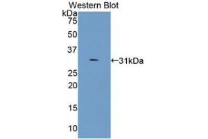Detection of Recombinant COL4a5, Human using Monoclonal Antibody to Collagen Type IV Alpha 5 (COL4a5) (COL4a5 antibody  (AA 1461-1685))