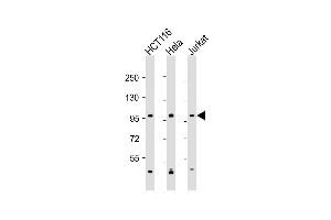 Western Blot at 1:2000 dilution Lane 1: HCT116 whole cell lysate Lane 2: Hela whole cell lysate Lane 3: Jurkat whole cell lysate Lysates/proteins at 20 ug per lane. (MANBA antibody  (AA 712-745))