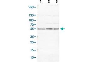 Western blot analysis of Lane 1: NIH-3T3 cell lysate (Mouse embryonic fibroblast cells) Lane 2: NBT-II cell lysate (Rat Wistar bladder tumour cells) with PSMD5 polyclonal antibody  at 1:100-1:500 dilution. (PSMD5 antibody)