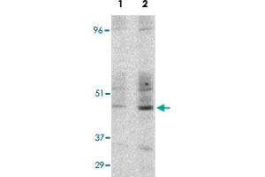 Western blot detection of GST-CD209 fusion protein expressed in E. (DC-SIGN/CD209 antibody  (Internal Region))