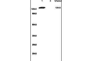 Lane 1: mouse brain lysates Lane 2: mouse embryo lysates probed with Anti GRM1 Polyclonal Antibody, Unconjugated (ABIN734663) at 1:200 in 4 °C. (mGluR1 + mGluR5 antibody  (AA 651-750))