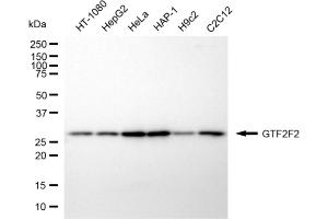 Western blotting analysis using GTF2F2 antibody (ABIN7798708). (Recombinant GTF2F2 antibody)