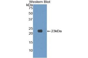 Detection of Recombinant KLRC2, Human using Polyclonal Antibody to Killer Cell Lectin Like Receptor Subfamily C, Member 2 (KLRC2) (KLRC2 antibody  (AA 19-190))