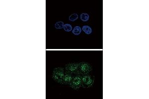 Confocal immunofluorescent analysis of Phospho-STAT3- Antibody  with HepG2 cell followed by Alexa Fluor 488-conjugated goat anti-rabbit lgG (green).