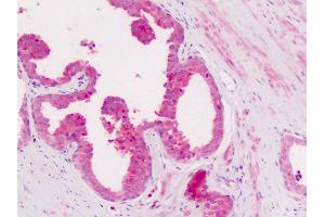 Anti-CD11c antibody IHC of human prostate. (CD11c antibody  (Internal Region))