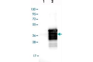 Western blot analysis of Lane 1: Negative control (vector only transfected HEK293T lysate), Lane 2: Over-expression Lysate (Co-expressed with a C-terminal myc-DDK tag (~3. (SIX Homeobox 1 antibody)