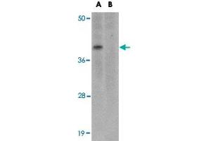 Western blot analysis of MC4R in rat brain tissue lysate with MC4R polyclonal antibody  at 1 ug/mL in (A) the absence and (B) the presence of blocking peptide. (MC4R antibody  (N-Term))