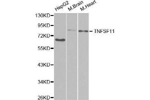 Western blot analysis of extracts of various cell lines, using TNFSF11 antibody. (RANKL antibody  (AA 78-317))