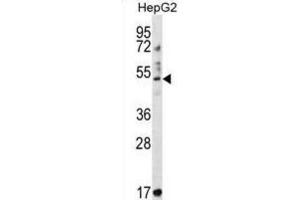 Western Blotting (WB) image for anti-Tripartite Motif Containing 11 (TRIM11) antibody (ABIN2997252)