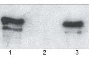 Western blot analysis of wild type p62, GST-tagged (human, recombinant) bound to: (1) glutathione-agarose and (3) ubiquitin-agarose (2: agarose control). (KHDRBS1 antibody  (AA 387-436))
