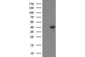 HEK293T cells were transfected with the pCMV6-ENTRY control (Left lane) or pCMV6-ENTRY RTN4IP1 (Right lane) cDNA for 48 hrs and lysed. (RTN4IP1 antibody)