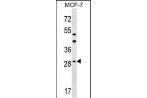 DHRS11 Antibody (Center) (ABIN1537768 and ABIN2849436) western blot analysis in MCF-7 cell line lysates (35 μg/lane). (DHRS11 antibody  (AA 115-142))
