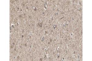 ABIN6266634 at 1/100 staining human brain tissue sections by IHC-P. (SIRPA antibody  (C-Term))