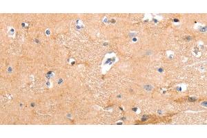 Immunohistochemistry of paraffin-embedded Human brain tissue using GPR64 Polyclonal Antibody at dilution 1:55 (GPR64 antibody)