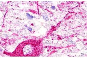 Image no. 1 for anti-MAS1 Oncogene Like Protein (MAS1L) (C-Term) antibody (ABIN1049042) (MAS1L antibody  (C-Term))