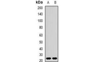 Western blot analysis of REEP1 expression in mouse brain (A), rat brain (B) whole cell lysates. (Receptor Accessory Protein 1 antibody)